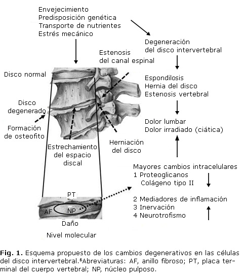 Anillo vertebral online